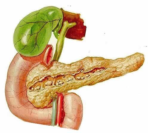 Острый Панкреатит