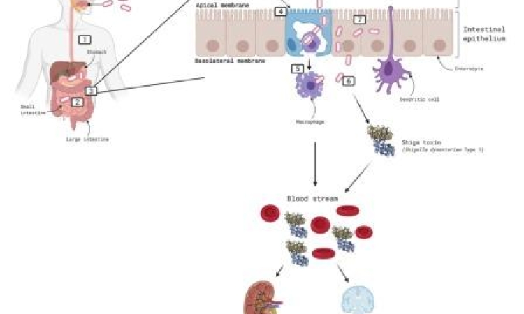 Дизентерия. Опасная кишечная инфекция. Этиология и патогенез.
