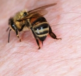 Укусы пчел и ос. Помощь при укусах.