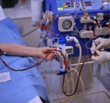 Эфферентные методы гемокоррекции в комплексной терапии бронхиальной астмы