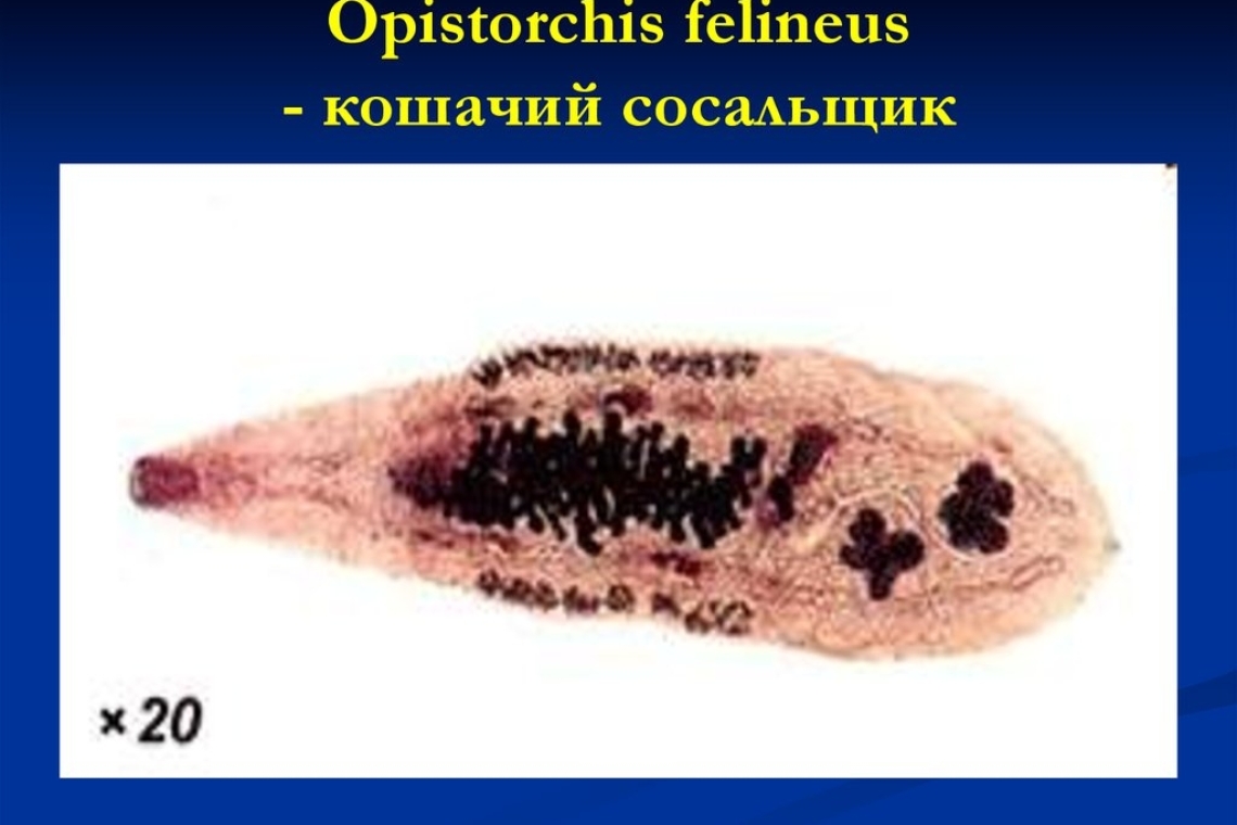 Описторхоз.