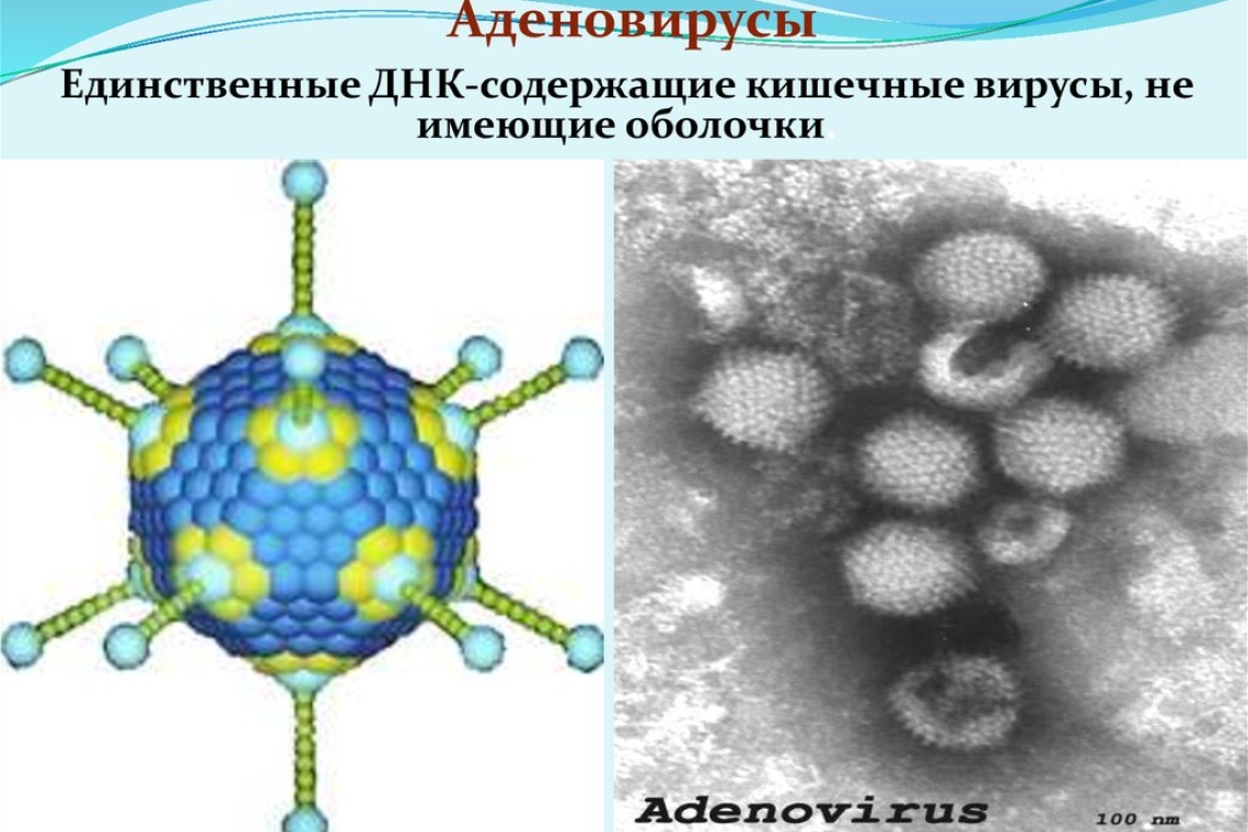 Аденовирус. Причина ОРВИ, вирусного конъюнктивита и гастрита.