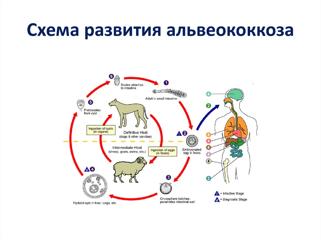 Альвеококкоз. Симптомы паразитов в организме человека.