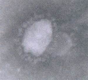 Коронавирусы. Причина ОРВИ, профилактика атипичной пневмонии.