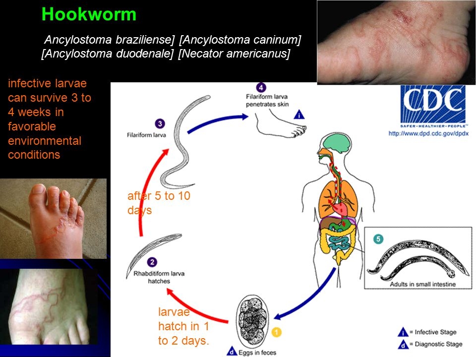 Анкилостомидоз и некатороз