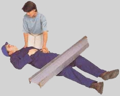 Краш синдром, синдром сдавления. Лечение, первая помощь.